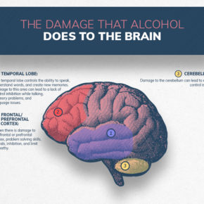 Infographics show the damage substance abuse can do to the brain